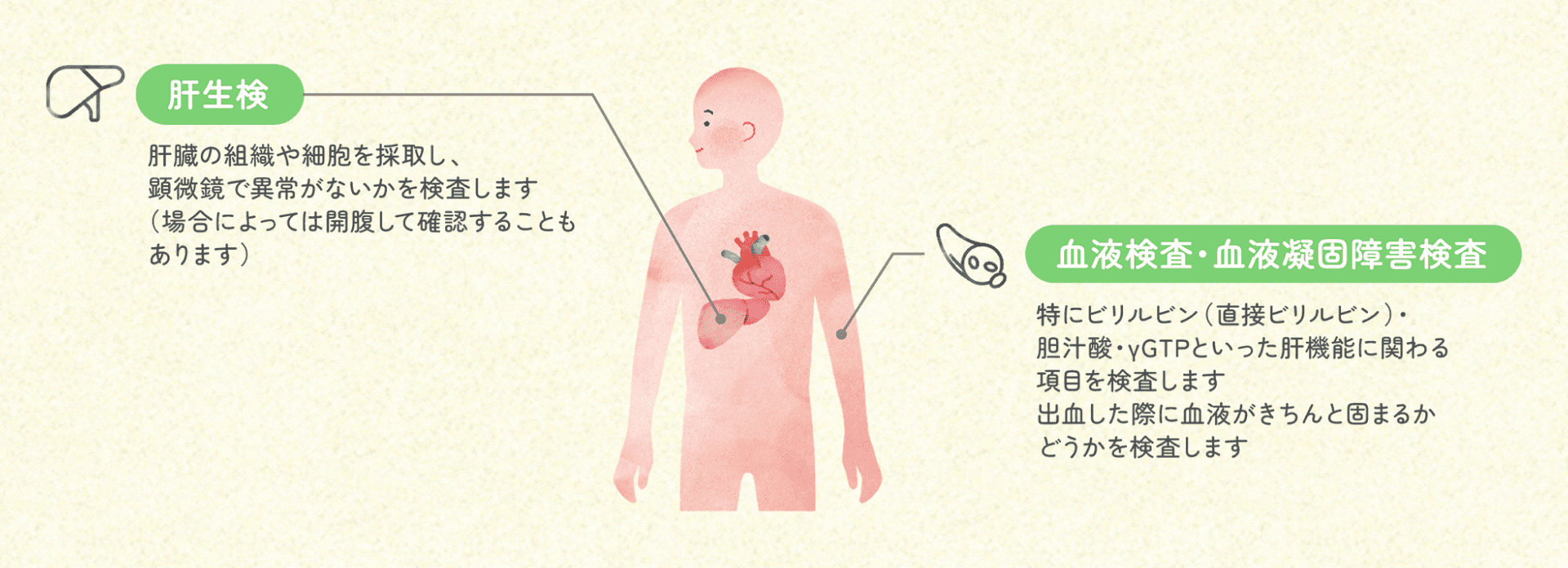 肝生検 肝臓の組織や細胞を採取し、顕微鏡で異常がないかを検査します(場合によっては開腹して確認することもあります) 血液検査・血液凝固障害検査 特にビリルビン(直接ビリルビン)・胆汁酸・γGTPといった肝機能に関わる項目を検査します。出血した際に血液がきちんと固まるかどうかを検査します