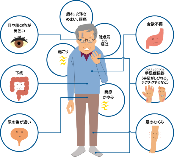 カボメティクス服用中に比較的起こりやすい主な症状