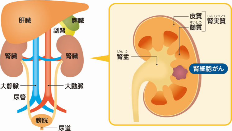 片 腎 気 を つける こと