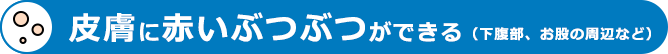 皮膚に赤いぶつぶつができる（下腹部、お股の周辺など）