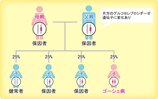 ゴーシェ病では親から子へ「グルコセレブロシダーゼ遺伝子の変異」が伝わる