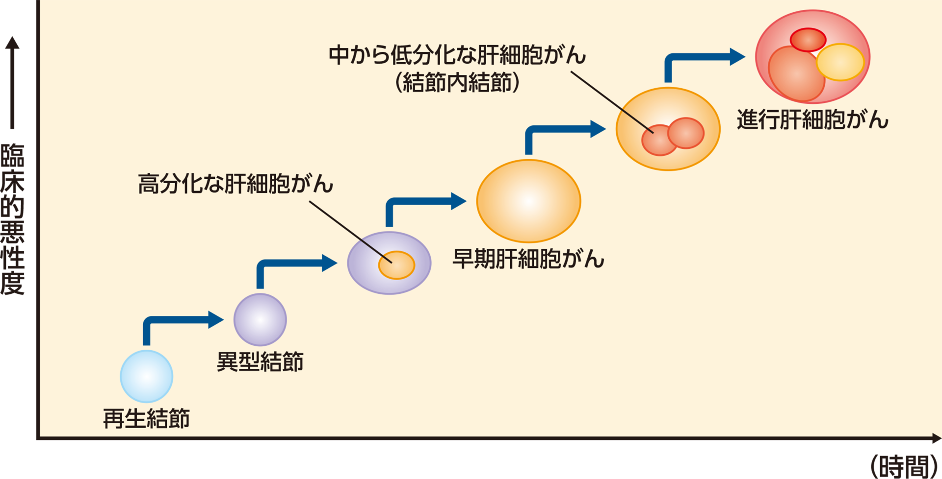 肝細胞がんの発生と進展