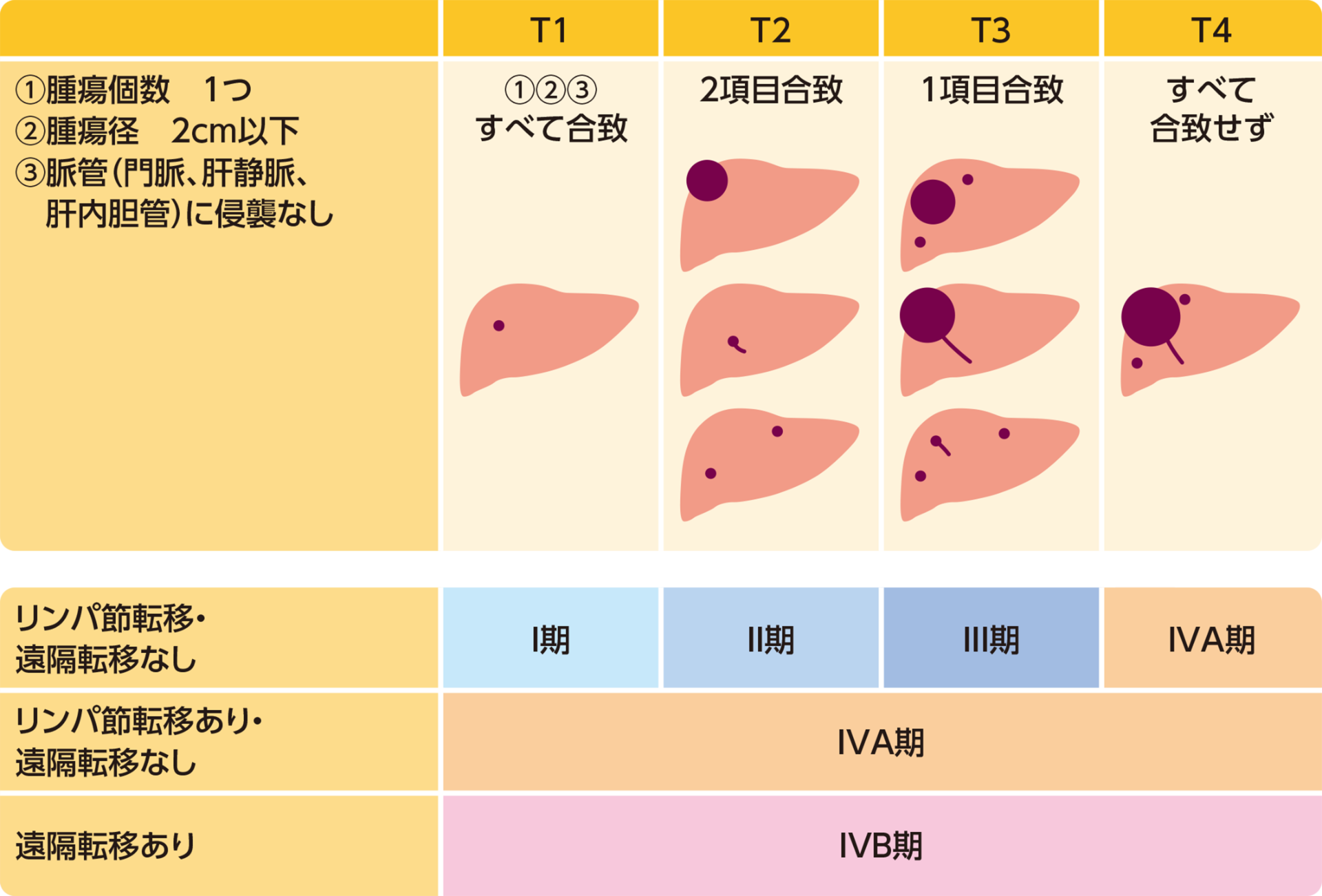 肝細胞がんの病期分類