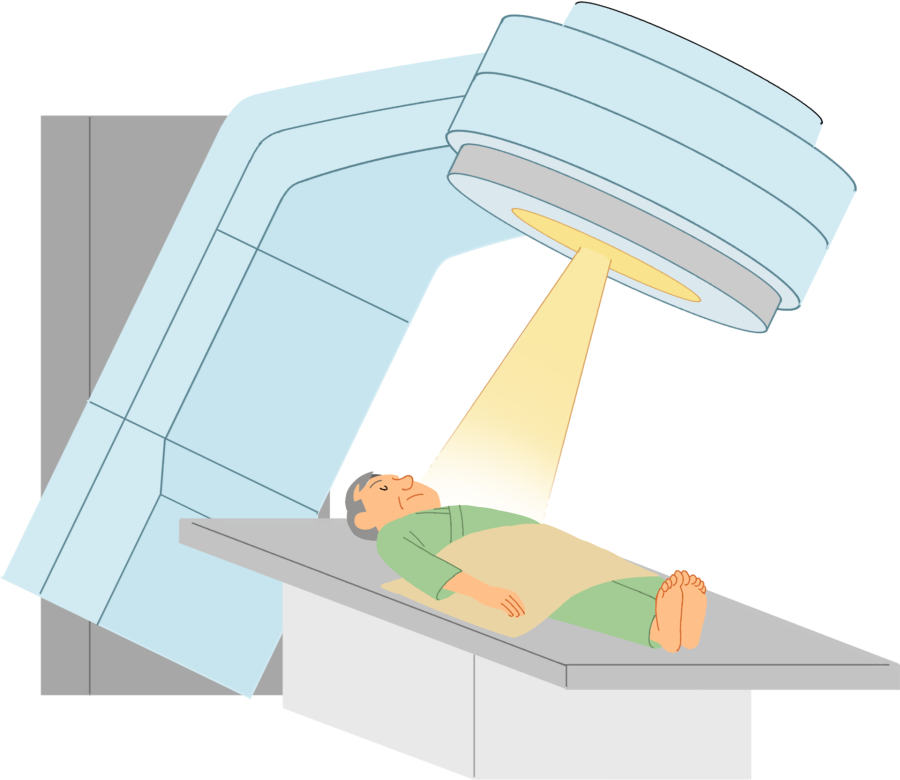 放射線療法