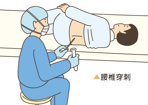 病理組織学的検査イメージ