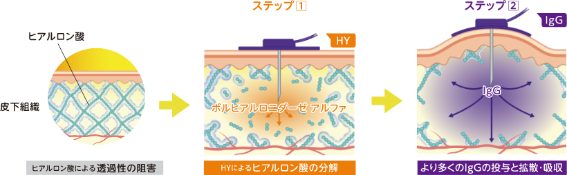 ステップ① HYによるヒアルロン酸の分解、ステップ② より多くのIgGの投与と拡散･吸収 イメージ