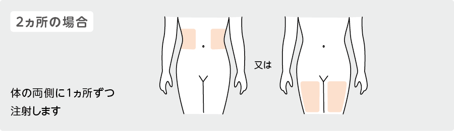 2ヵ所の場合の注射部位イラスト