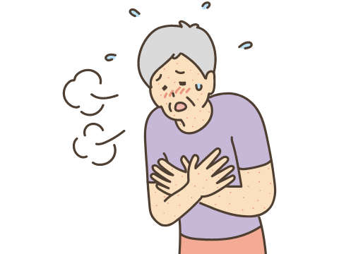 アナフィラキシー反応イメージ