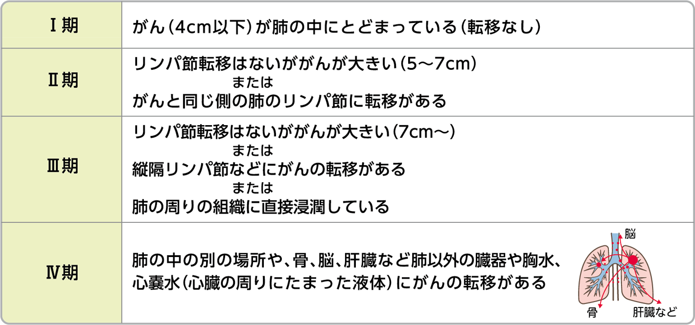 ステージ 肺がん