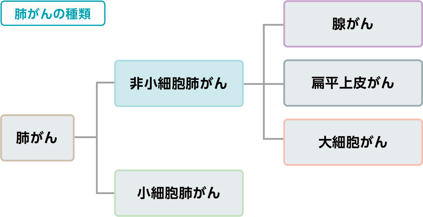 肺がんの種類