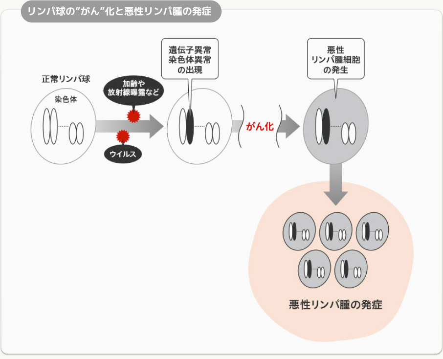 リンパ球の”がん”化と悪性リンパ腫の発症