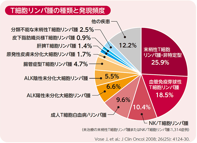 T細胞リンパ腫の種類と発現頻度