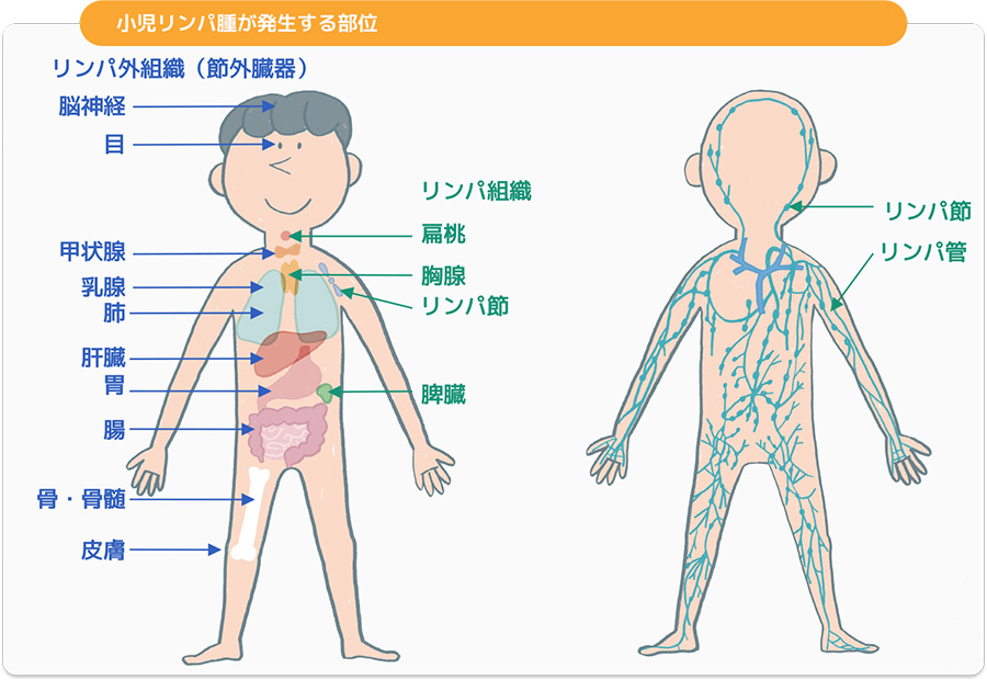 悪性 リンパ腫 初期 症状 ブログ