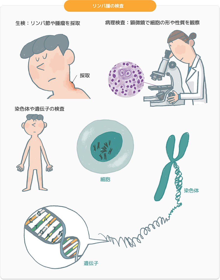 リンパ腫の検査