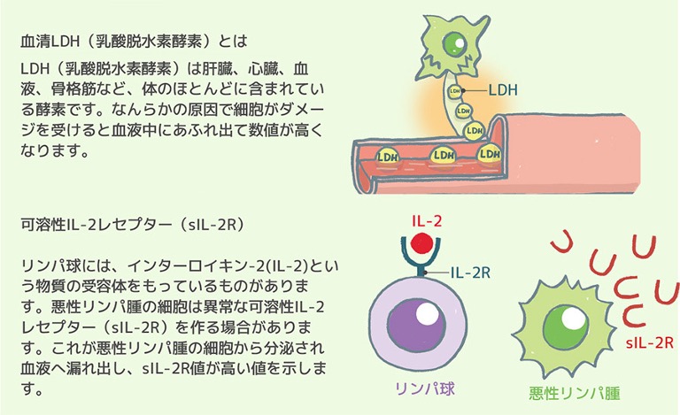 血清LDH（乳酸脱水素酵素）とは