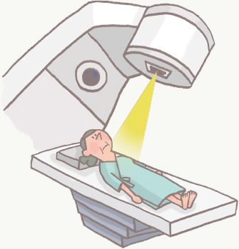 放射線療法とは