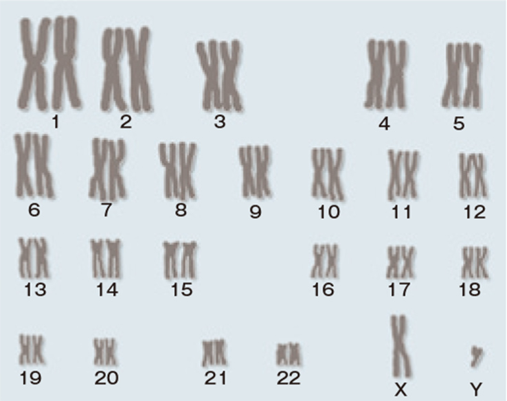 染色体イメージ図