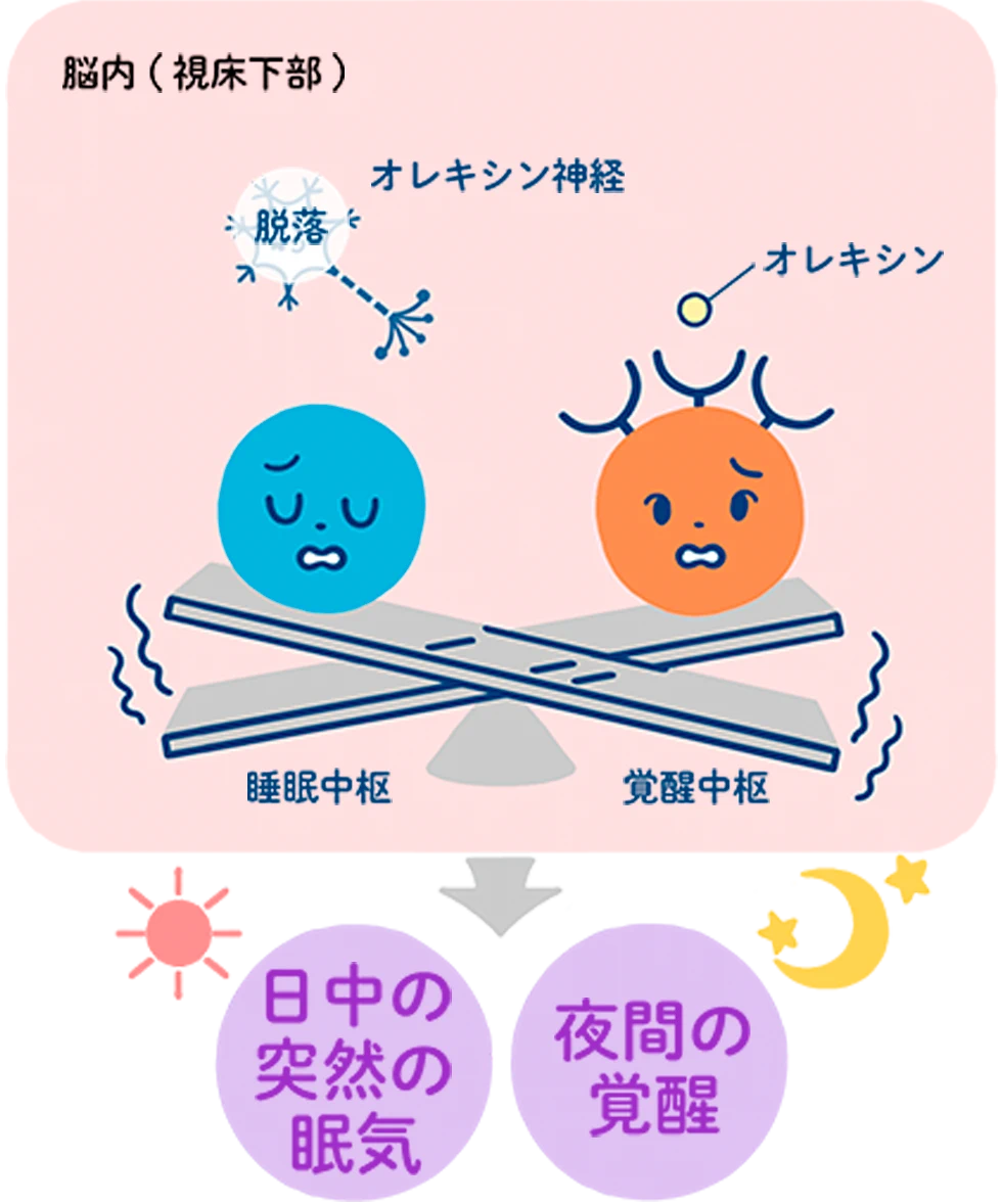 睡眠・覚醒のメカニズムを、睡眠中枢と覚醒中枢が乗ったシーソーで表した図です。ナルコレプシータイプ1では、脳内（視床下部）でオレキシン神経が脱落することで、オレキシンがほとんど分泌されなくなっています。これにより、シーソーのバランスが崩れて不安定になり、その結果として「日中の突然の眠気」と「夜間の覚醒」が引き起こされる様子が描かれています。