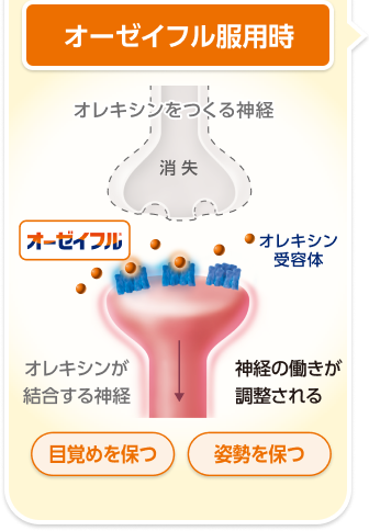 ナルコレプシータイプ1の病態とオーゼイフルの作用