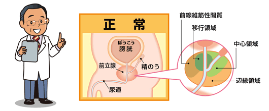 前立腺イメージ