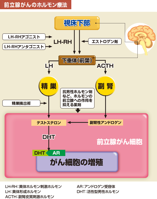 前立腺がんのホルモン療法