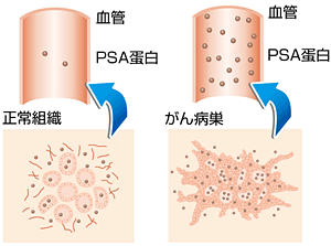 正常組織・がん病巣イメージ