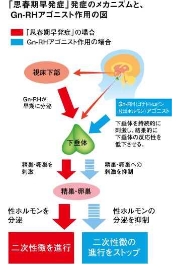 思春 期 そう は つ 症