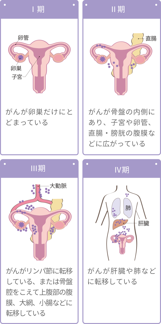 卵巣 癌 ブログ わたし は わたし