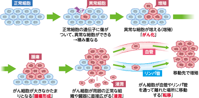 がん細胞の発生と増殖・浸潤・転移