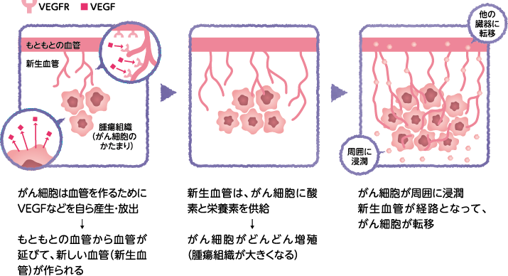 新生血管の形成とがん細胞が増殖し続けられるしくみ