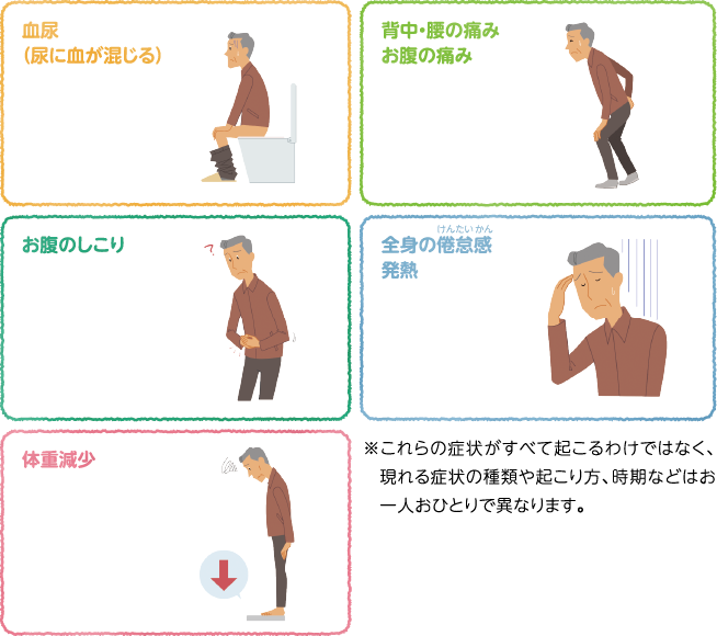 が 症状 腎臓 ん 腎臓の痛みと背部痛を区別する方法: 11