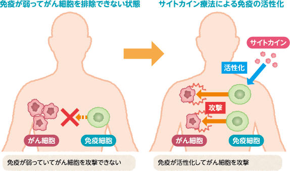 サイトカイン療法による免疫の活性化