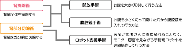 腎細胞がんの手術：術式と方法