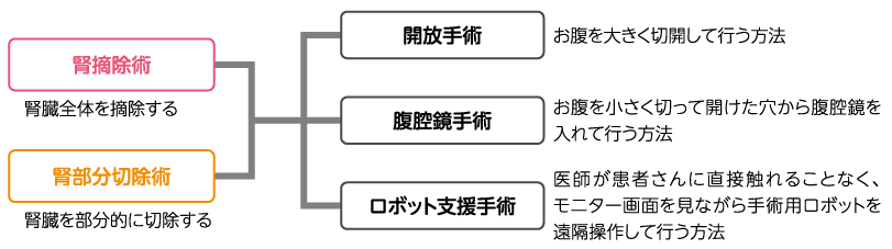 腎細胞がんの手術:術式と方法